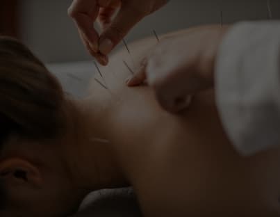 Columbus Ohio Acupuncturist