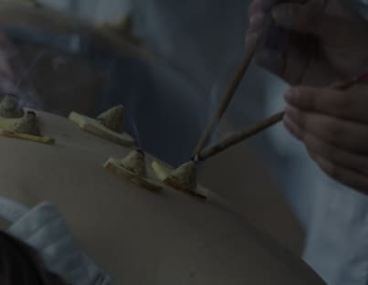 Delaware Ohio Acupuncturist