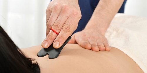 Acupuncture-Marysville-Ohio-21