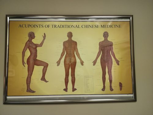 Acupuncture-Marysville-Ohio-3