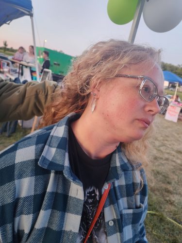 Acupuncture-Marysville-Ohio-6